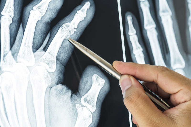 Рентген: польза и противопоказания картинка